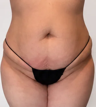 Super Meltdown Session – Antes · Frontal – Sculptology Málaga